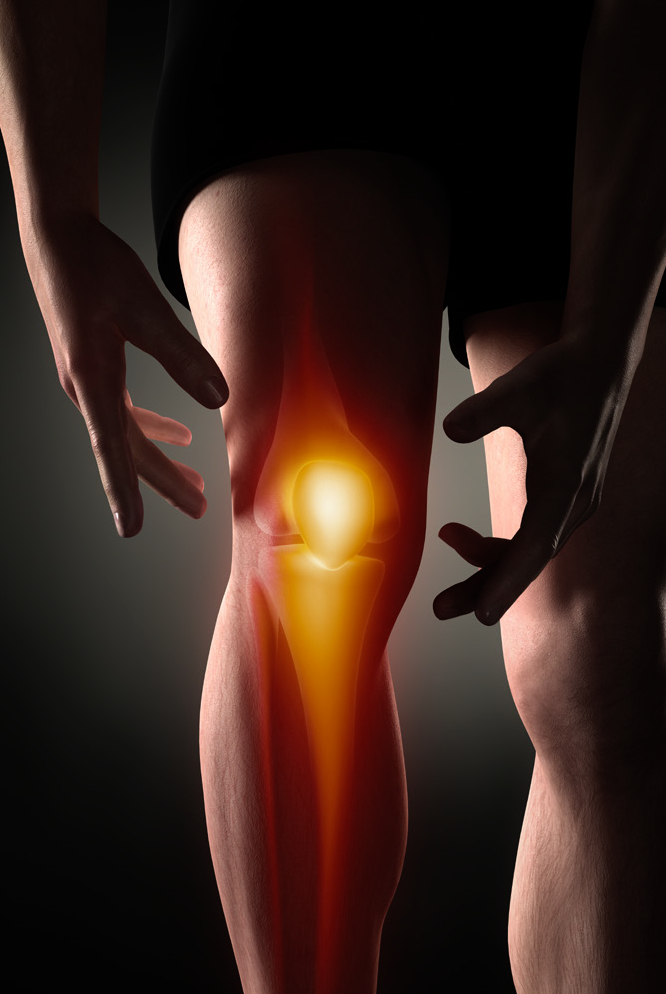 Advice On Acl Tears From An Orthopedic Surgeon Memphis Health And Fitness