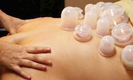 Cupping Therapy