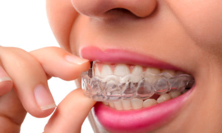 Fix your Smile, Fit Your Lifestyle with Invisalign®