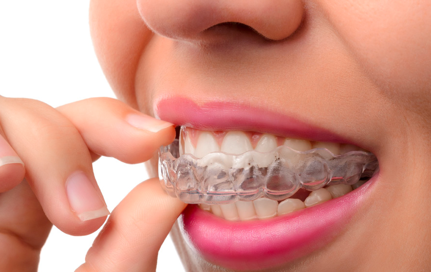 Fix your Smile, Fit Your Lifestyle with Invisalign®