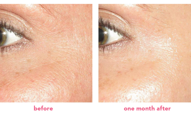 Summer Skin: Look Rejuvenated when the Heat is On