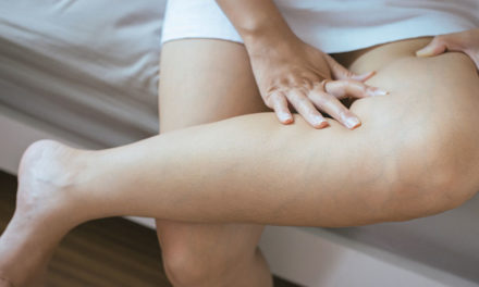 What is DVT, and why is it concerning for my health?