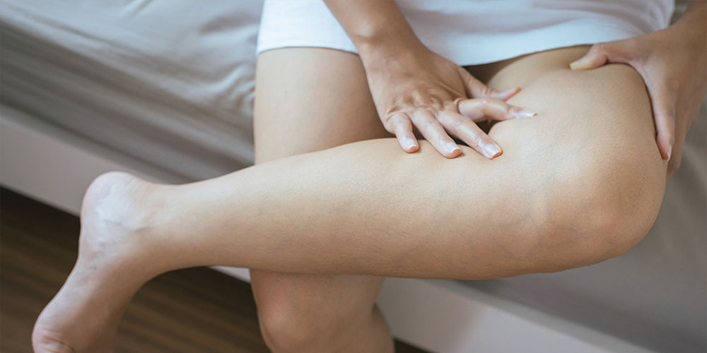 What is DVT, and why is it concerning for my health?