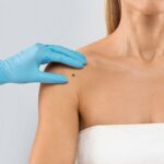 Key Strategies for Improving Outcomes in Melanoma