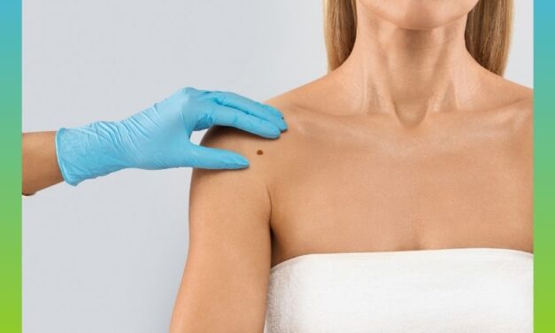 Key Strategies for Improving Outcomes in Melanoma